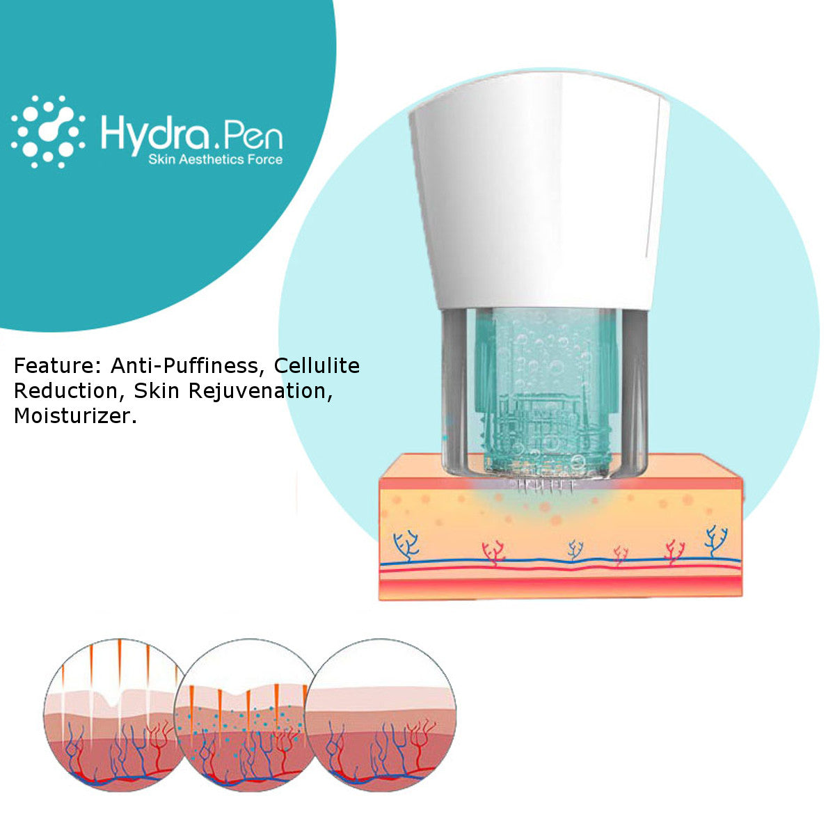 Hydra Pen - H2 - Image 8